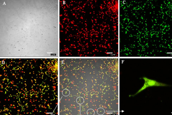 活体动物体内光学成像技术主要有几种标记方法介绍！